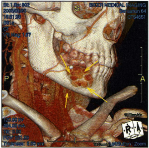 biopsy scan