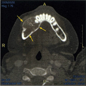 biopsy x-ray