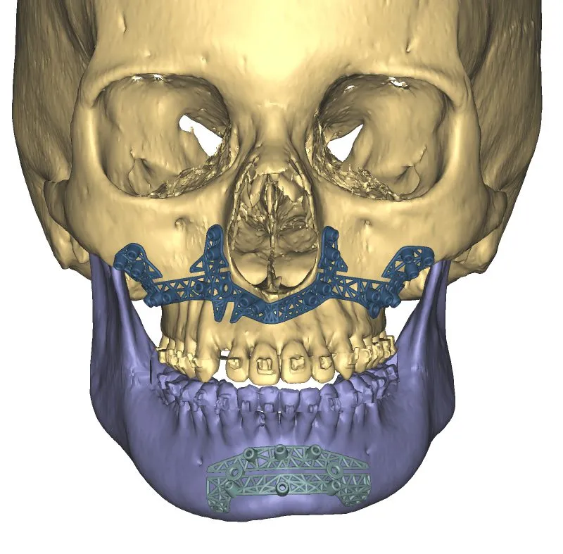 digital image of skull